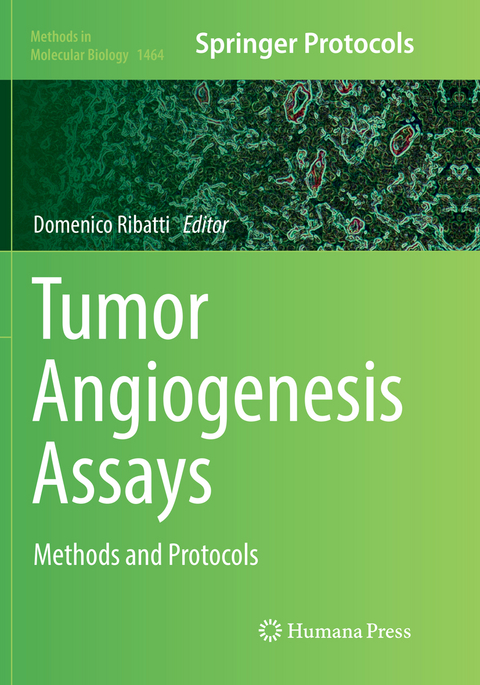 Tumor Angiogenesis Assays - 