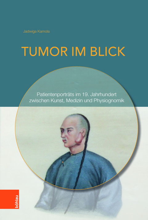 Tumor im Blick - Jadwiga Kamola