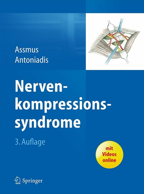 Nervenkompressionssyndrome - 