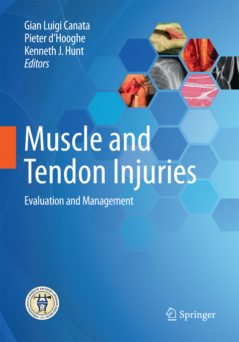 Muscle and Tendon Injuries - 