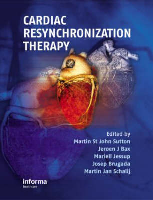 Cardiac Resynchronization Therapy - 