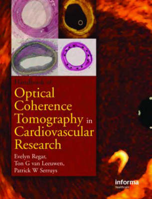 Optical Coherence Tomography in Cardiovascular Research - 