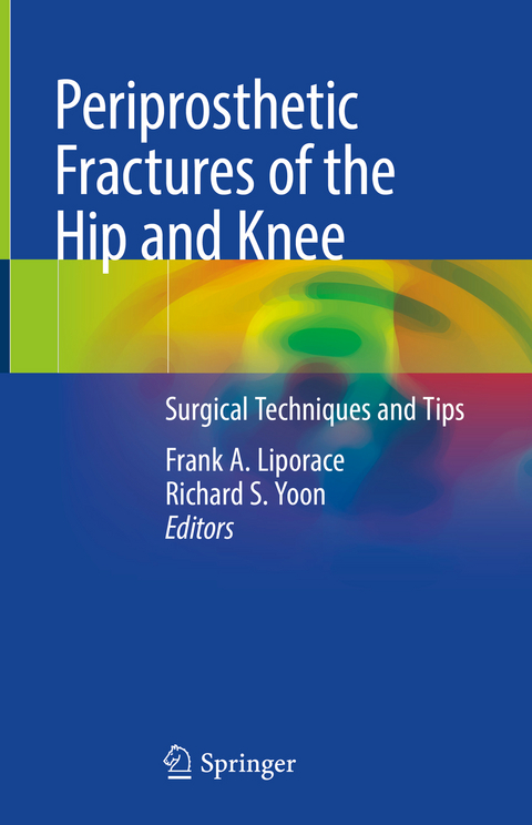 Periprosthetic Fractures of the Hip and Knee - 