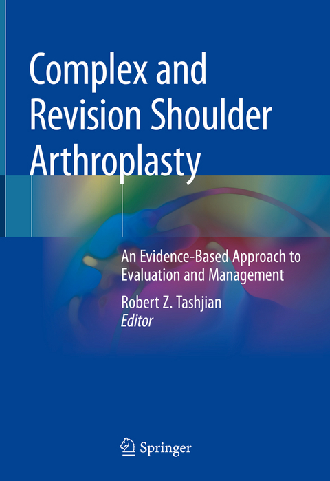 Complex and Revision Shoulder Arthroplasty - 