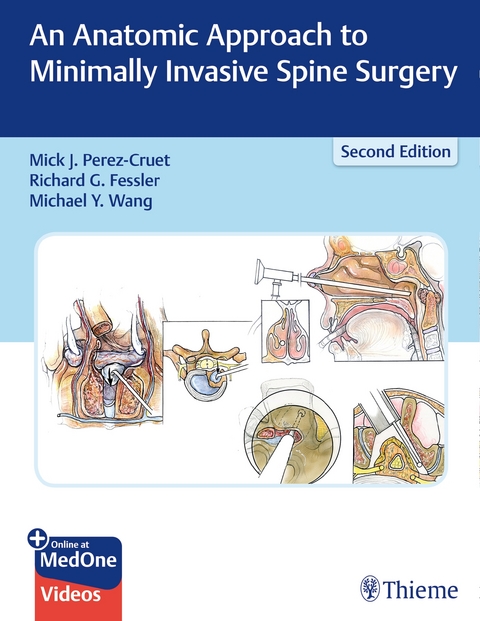 An Anatomic Approach to Minimally Invasive Spine Surgery - 