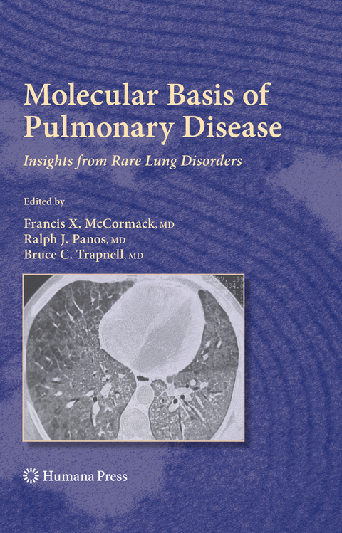 Molecular Basis of Pulmonary Disease - 
