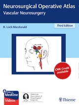 Neurosurgical Operative Atlas: Vascular Neurosurgery - Macdonald, R. Loch