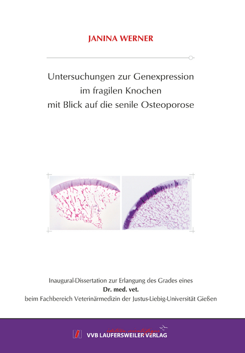 Untersuchungen zur Genexpression im fragilen Knochen mit Blick auf die senile Osteoporose - Janina Werner