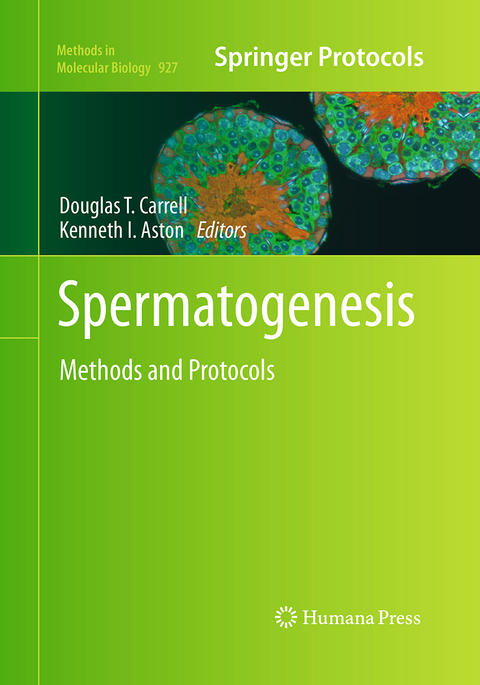 Spermatogenesis - 