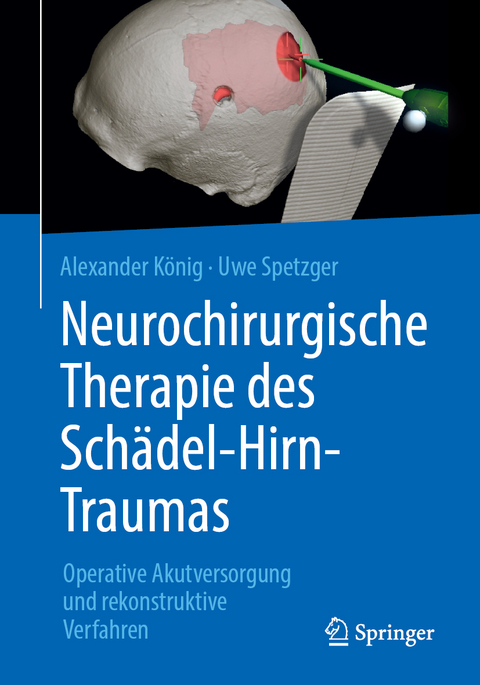 Neurochirurgische Therapie des Schädel-Hirn-Traumas - Alexander König, Uwe Spetzger