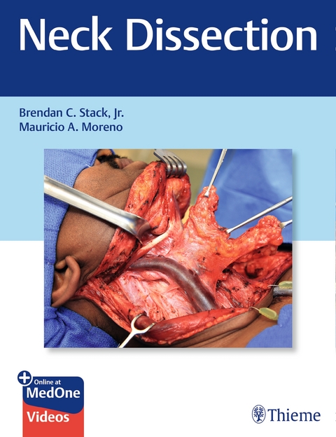 Neck Dissection - Jr. Stack  Brendan, Mauricio Moreno