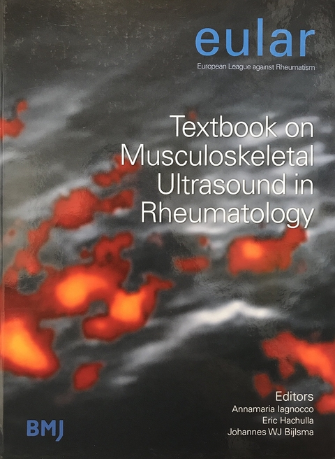 Eular Textbook on Musculoskeletal Ultrasound in Rheumatology - 