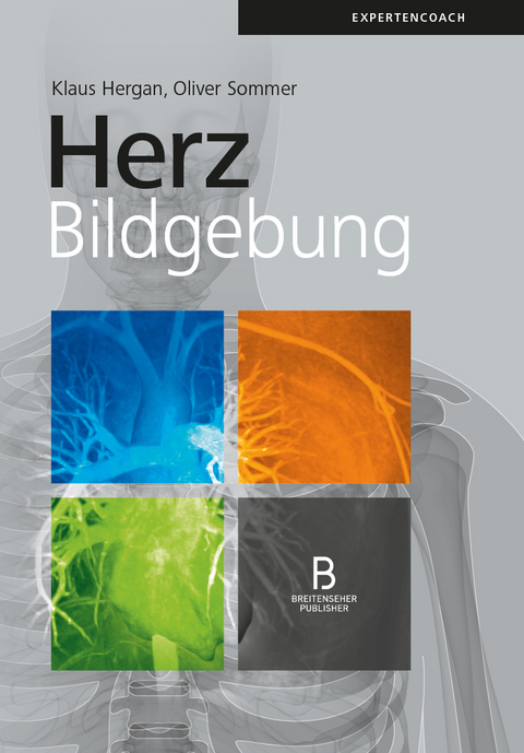 Herzbildgebung - 