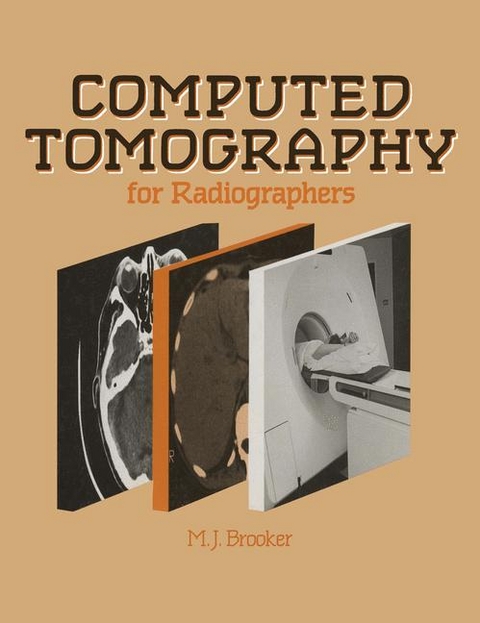 Computed Tomography for Radiographers - M.J. Brooker