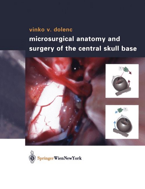 Microsurgical Anatomy and Surgery of the Central Skull Base - Vinko V. Dolenc