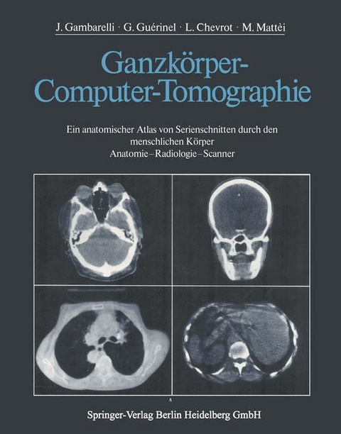 Ganzkörper-Computer-Tomographie - J. Gambarelli, G. Guerinel, L. Chevrot, M. Mattei