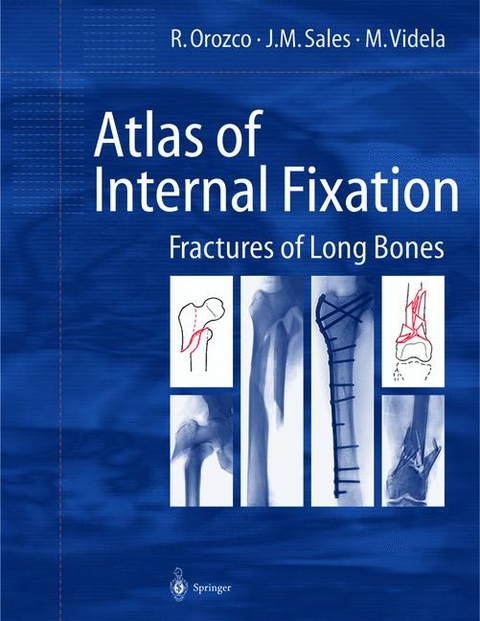 Atlas of Internal Fixation - R. Orozco, J.M. Sales, M. Videla