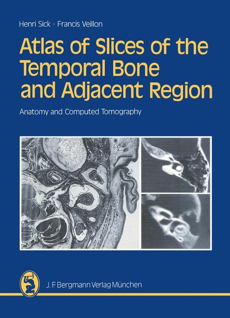 Atlas of Slices of the Temporal Bone and Adjacent Region - Henri Sick, Francis Veillon