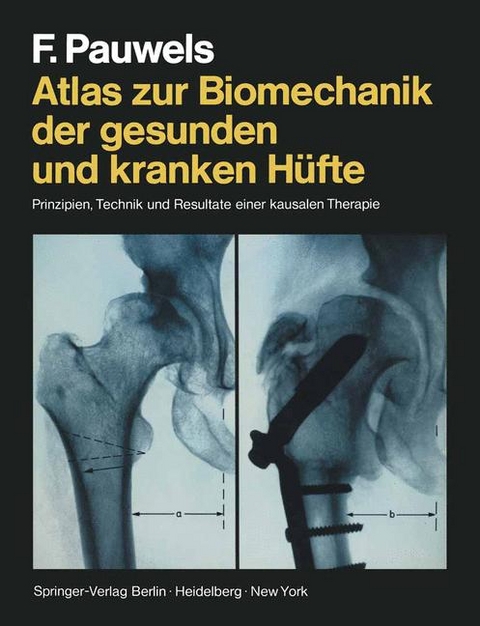 Atlas zur Biomechanik der gesunden und kranken Hüfte - F. Pauwels