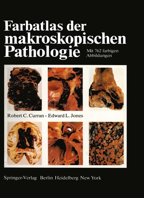 Farbatlas der makroskopischen Pathologie - R. C. Curran, E. L. Jones