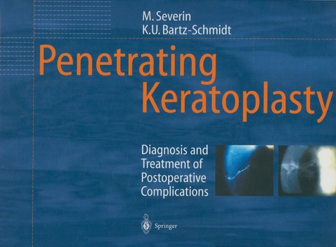 Penetrating Keratoplasty - Maria Severin, Karl-Ulrich Bartz-Schmidt