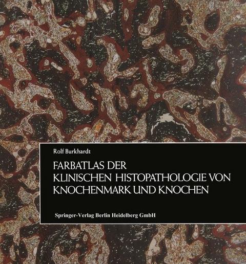 Farbatlas der klinischen Histopathologie von Knochenmark und Knochen - Rolf Burkhardt