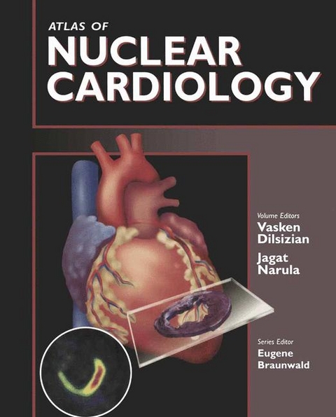 Atlas of Nuclear Cardiology - 