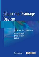 Glaucoma Drainage Devices - 