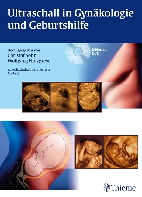 Ultraschall in Gynäkologie und Geburtshilfe - 