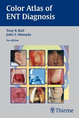 Bull's Color Atlas of ENT Diagnosis - Almeyda, John S.; Hartley, Benjamin