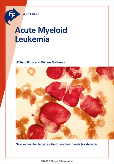 Fast Facts: Acute Myeloid Leukemia - William Blum, Vikram Mathews
