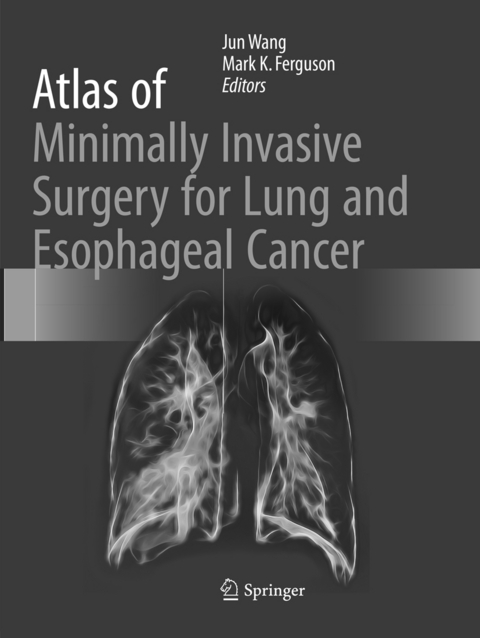 Atlas of Minimally Invasive Surgery for Lung and Esophageal Cancer - 