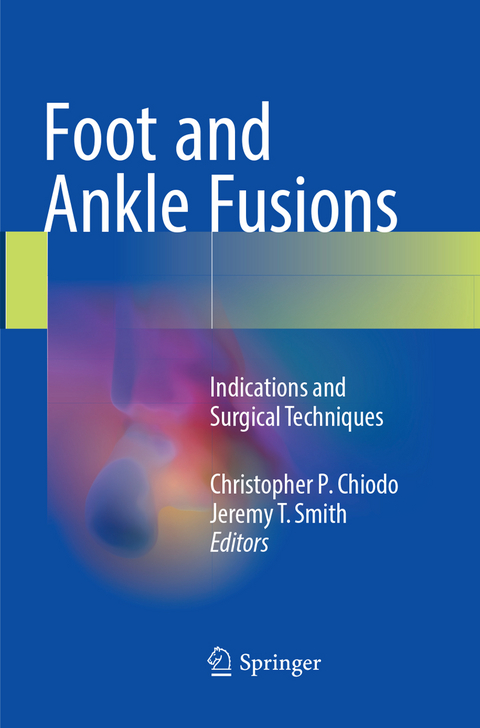 Foot and Ankle Fusions - 