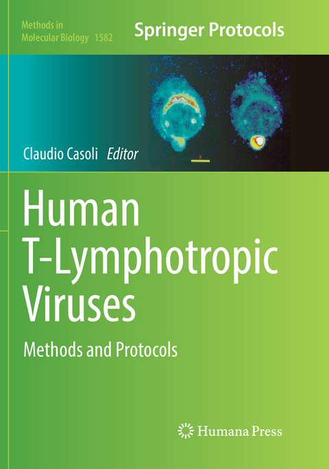 Human T-Lymphotropic Viruses - 