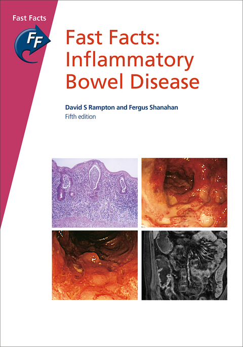 Fast Facts: Inflammatory Bowel Disease - David S. Rampton, Fergus Shanahan