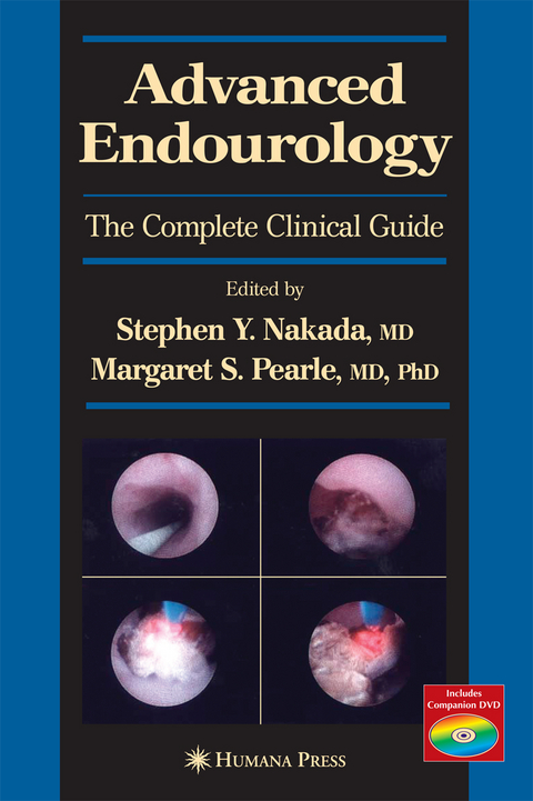 Advanced Endourology - 