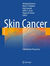 Skin Cancer - A World-Wide Perspective - 