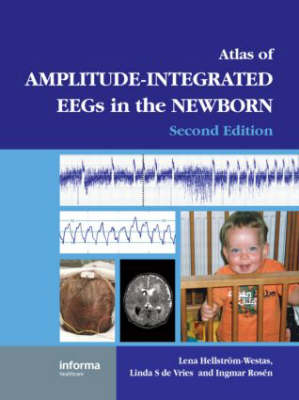 An Atlas of Amplitude-Integrated EEGs in the Newborn - 