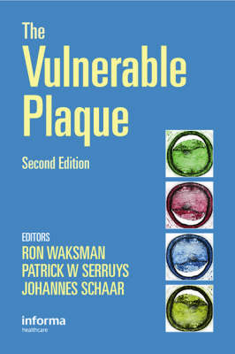 Handbook of the Vulnerable Plaque - 