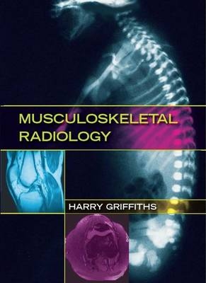 Musculoskeletal Radiology -  Harry Griffiths