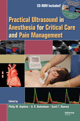 Practical Ultrasound in Anesthesia for Critical Care and Pain Management - 