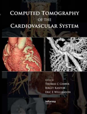 Computed Tomography of the Cardiovascular System - 