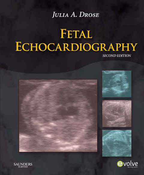 Fetal Echocardiography - E-Book -  Julia A. Drose