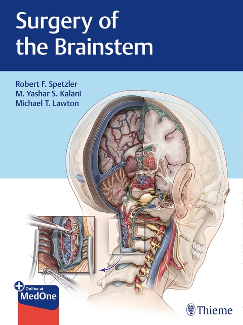 Surgery of the Brainstem - 