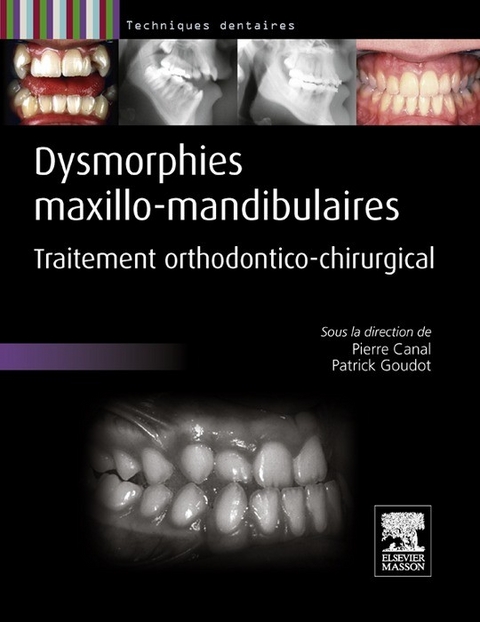 Dysmorphies maxillo-mandibulaires -  Pierre Canal,  Patrick Goudot