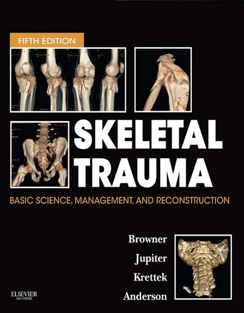 Skeletal Trauma E-Book -  Paul A Anderson,  Bruce D. Browner,  Jesse Jupiter,  Christian Krettek