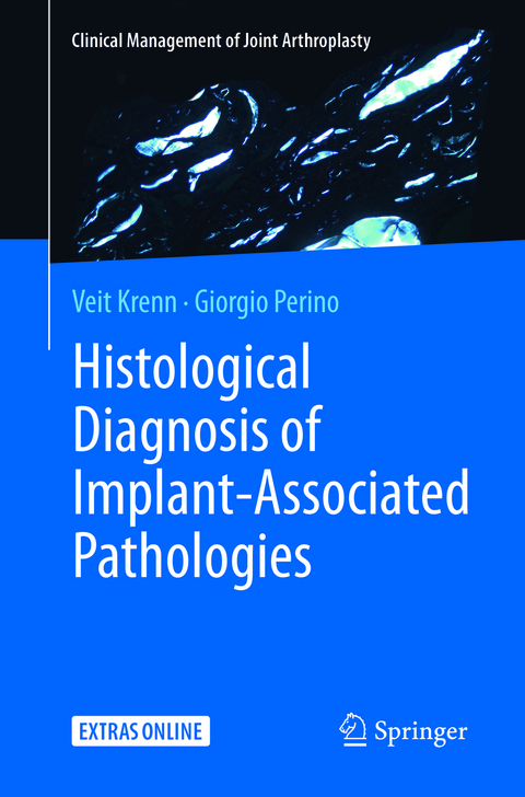 Histological Diagnosis of Implant-associated Pathologies - Veit Krenn, Giorgio Perino