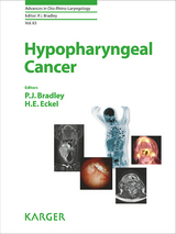Hypopharyngeal Cancer - 
