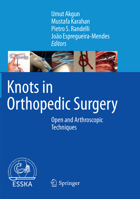 Knots in Orthopedic Surgery - 