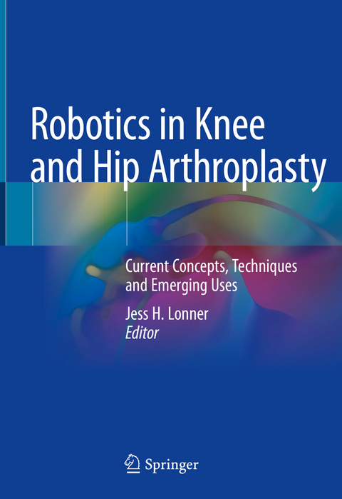 Robotics in Knee and Hip Arthroplasty - 